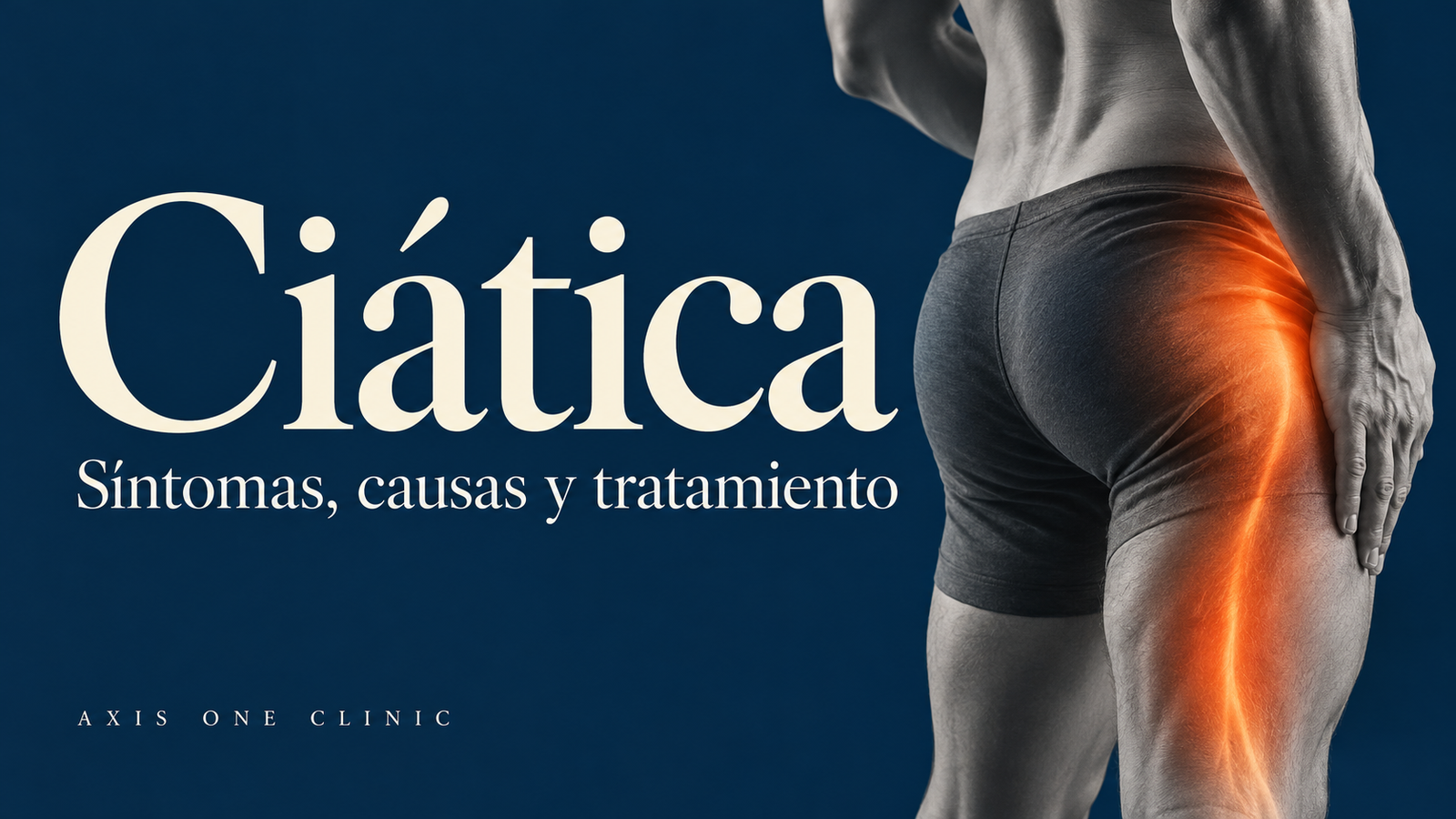 Ciática: dolor ilustrado desde el glúteo hacia la parte posterior de la pierna